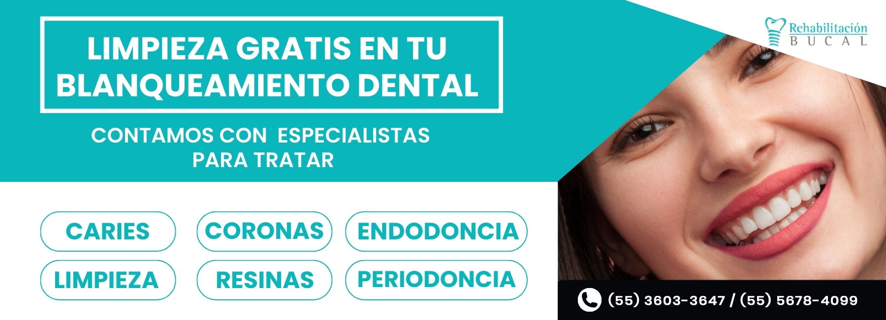 Rehabilitacion Bucal